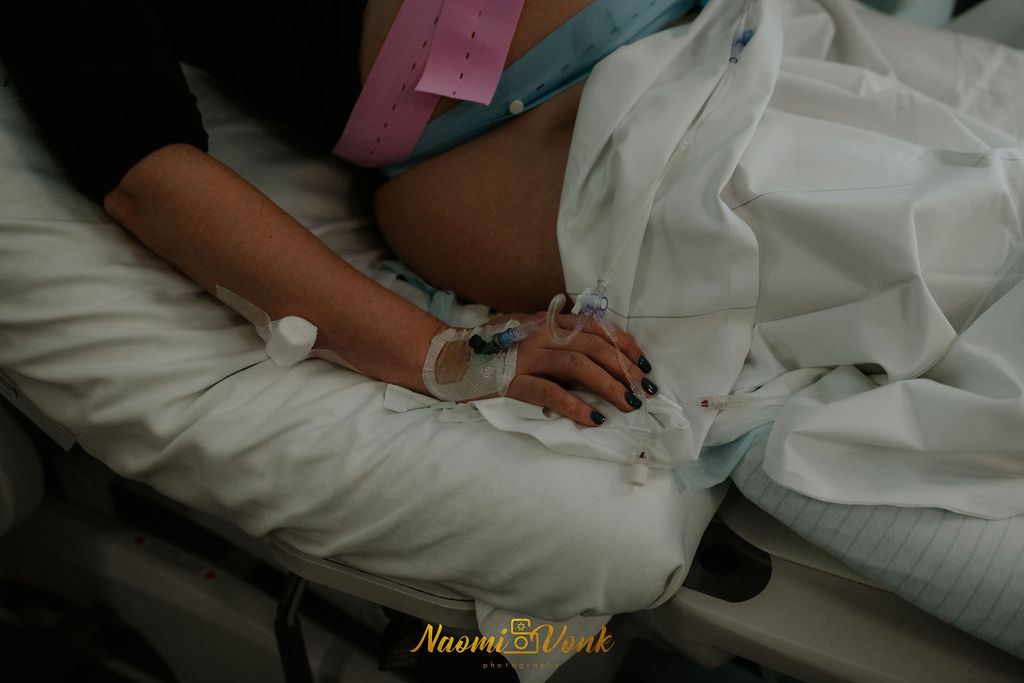 CTG en infuus (oxytocine)